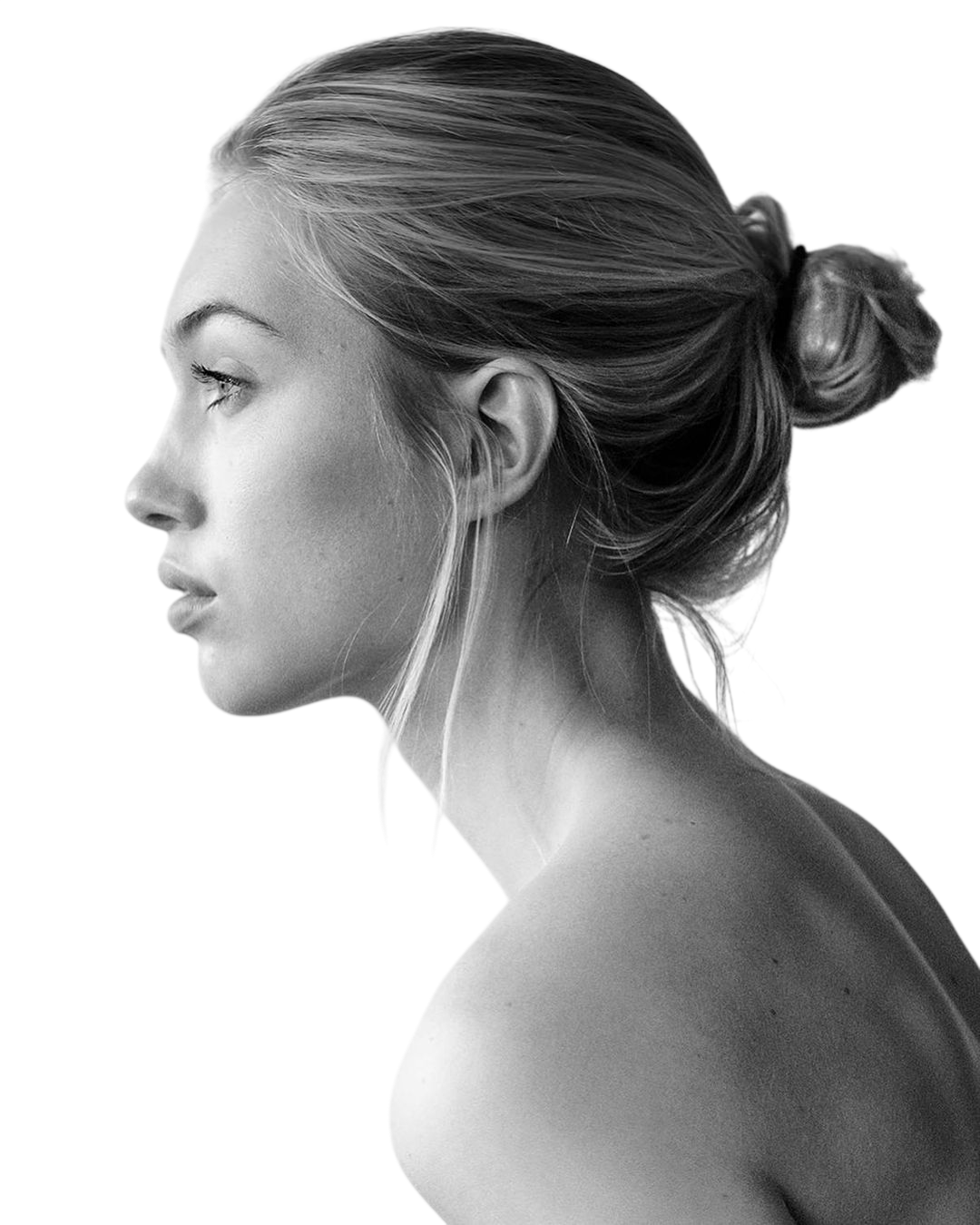 Ринопластика — профиль лица