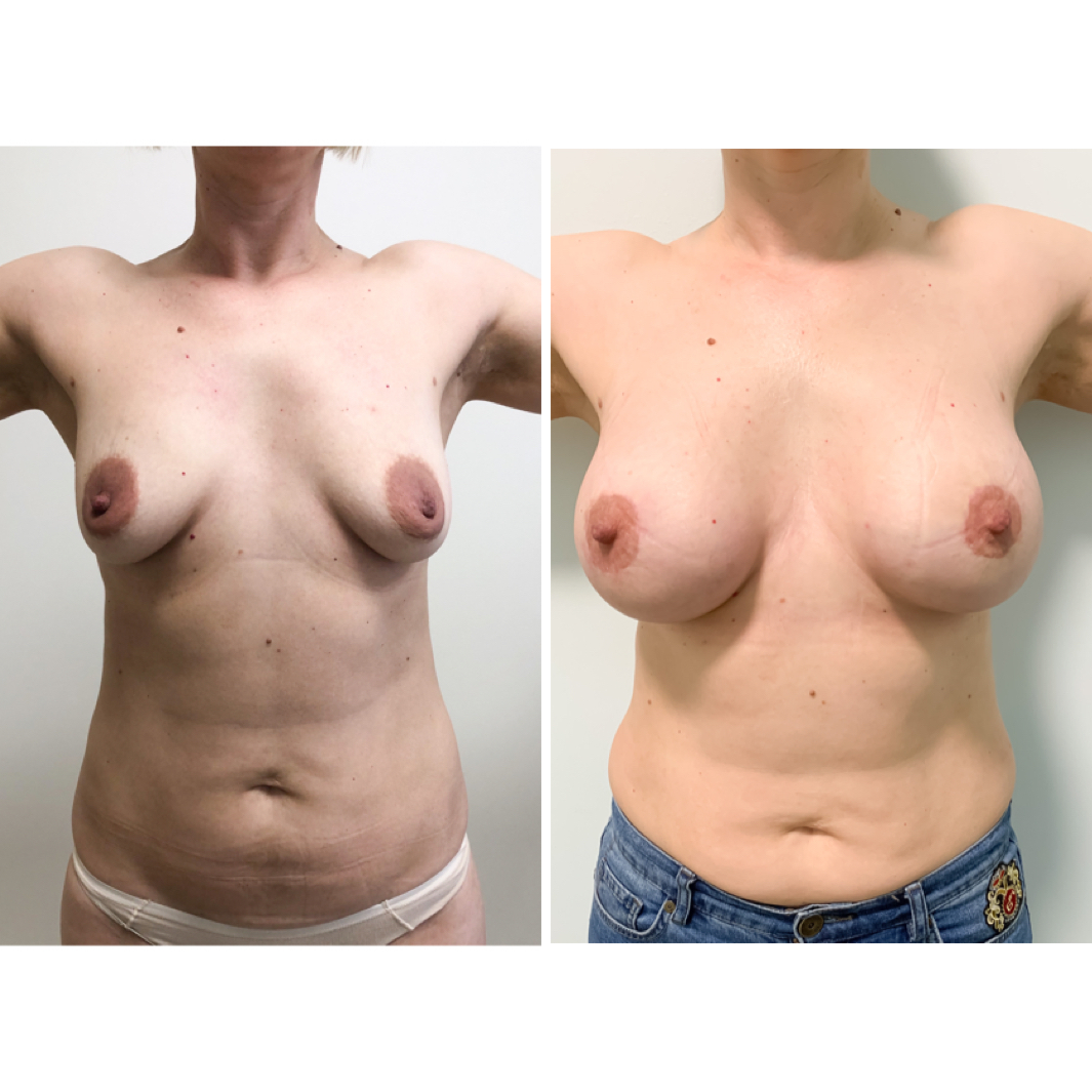голая на операции фото до и после фото 8