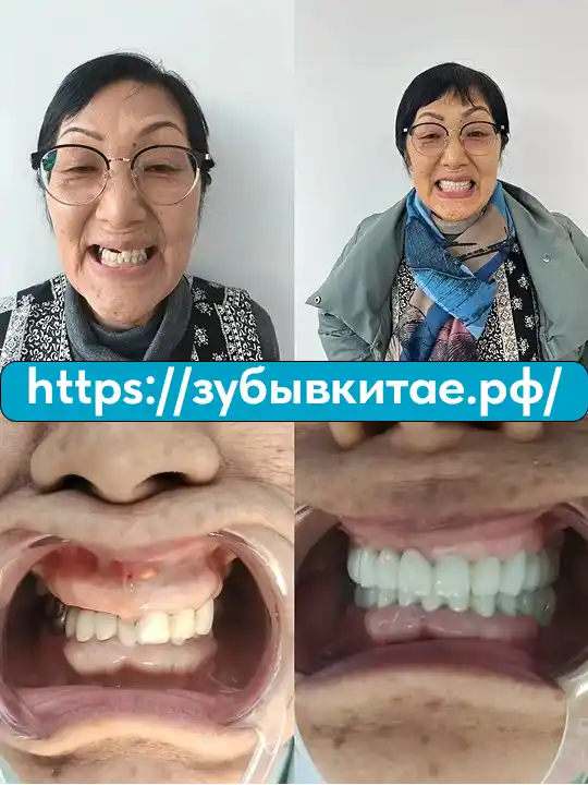 До и после — кейс 7