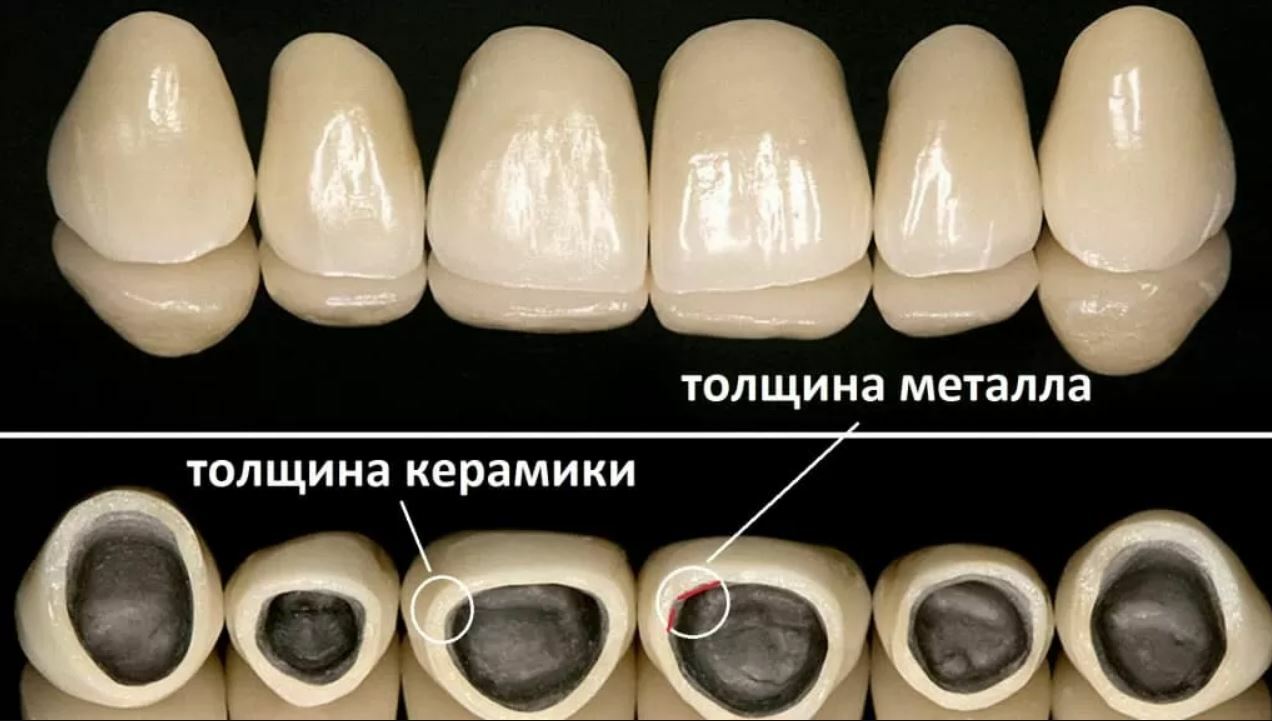 Диоксид циркония в стоматологии презентация