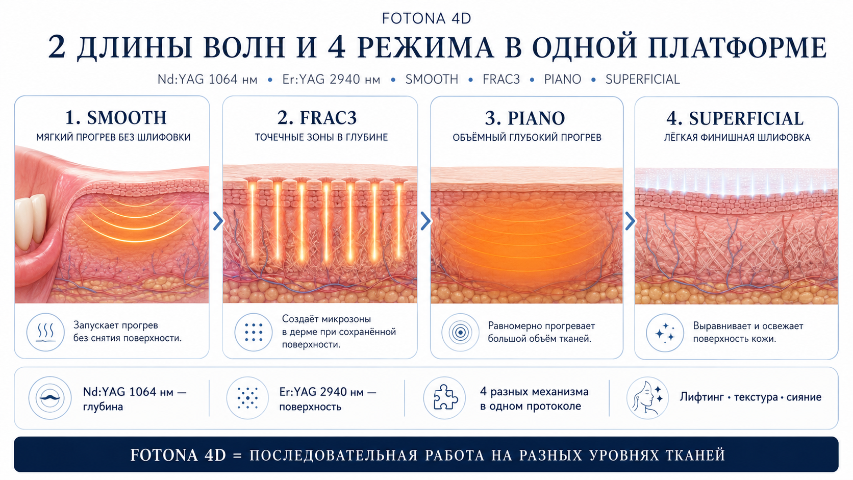 Процедура Fotona4D: SMOOTH, FRAC3, PIANO, SupErficial