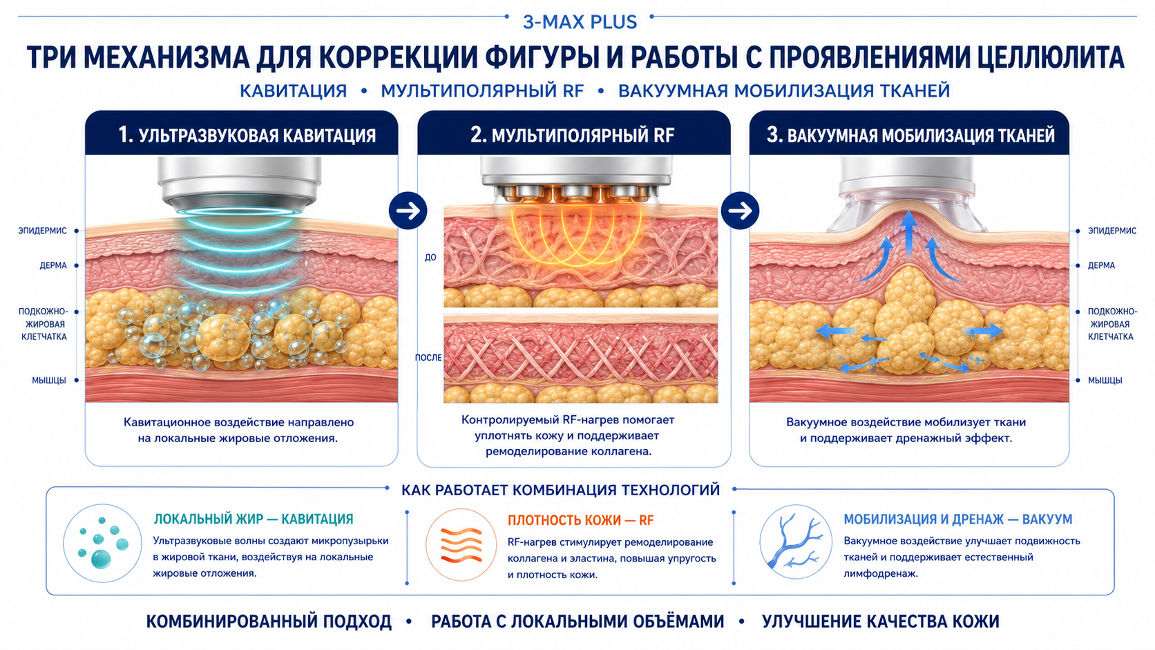 3-MAX: схема технологий и воздействия
