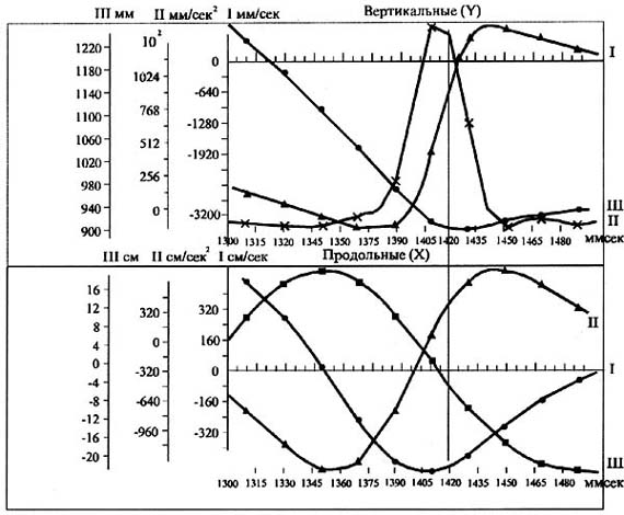 Рис. 2. Изменения величин вертикальных (верхний рис.) и продольных (нижний рис.) составляющих траектории движения ц.м. молотка (кривая и шкала Ш), скорости его движения (кривая и шкала I) и ускорения (кривая и шкала П). Вертикальной линией отмечен момент соприкосновения с ударяемой поверхностью (ориг. 1993 г.)