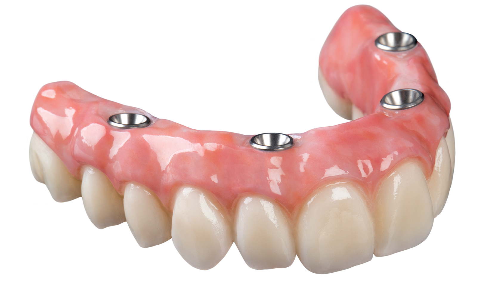Протез на челюсть без зубов. Условно-съёмный протез ( all-on-4). Несъёмный мостовидный протез челюсти. Имплантация челюсти на 4 имплантах. Протез челюсти несъемный.