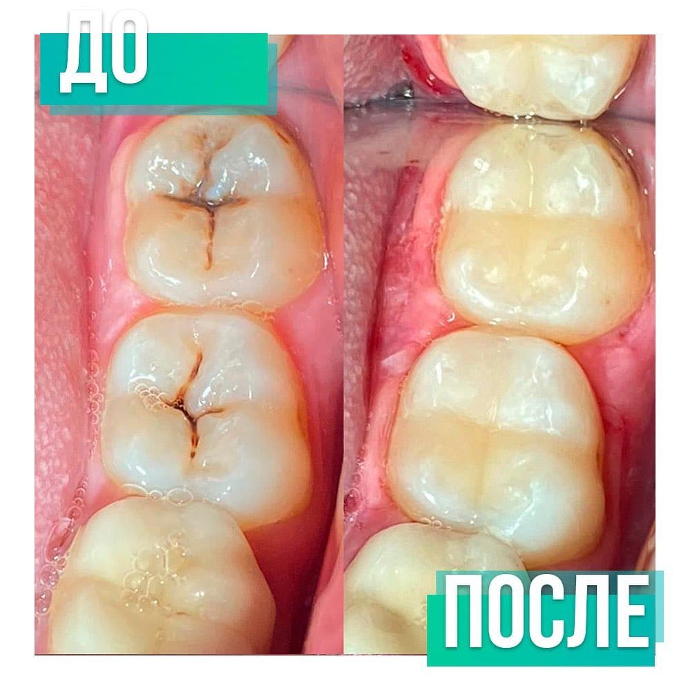 Стоматология Like Stom Саратов