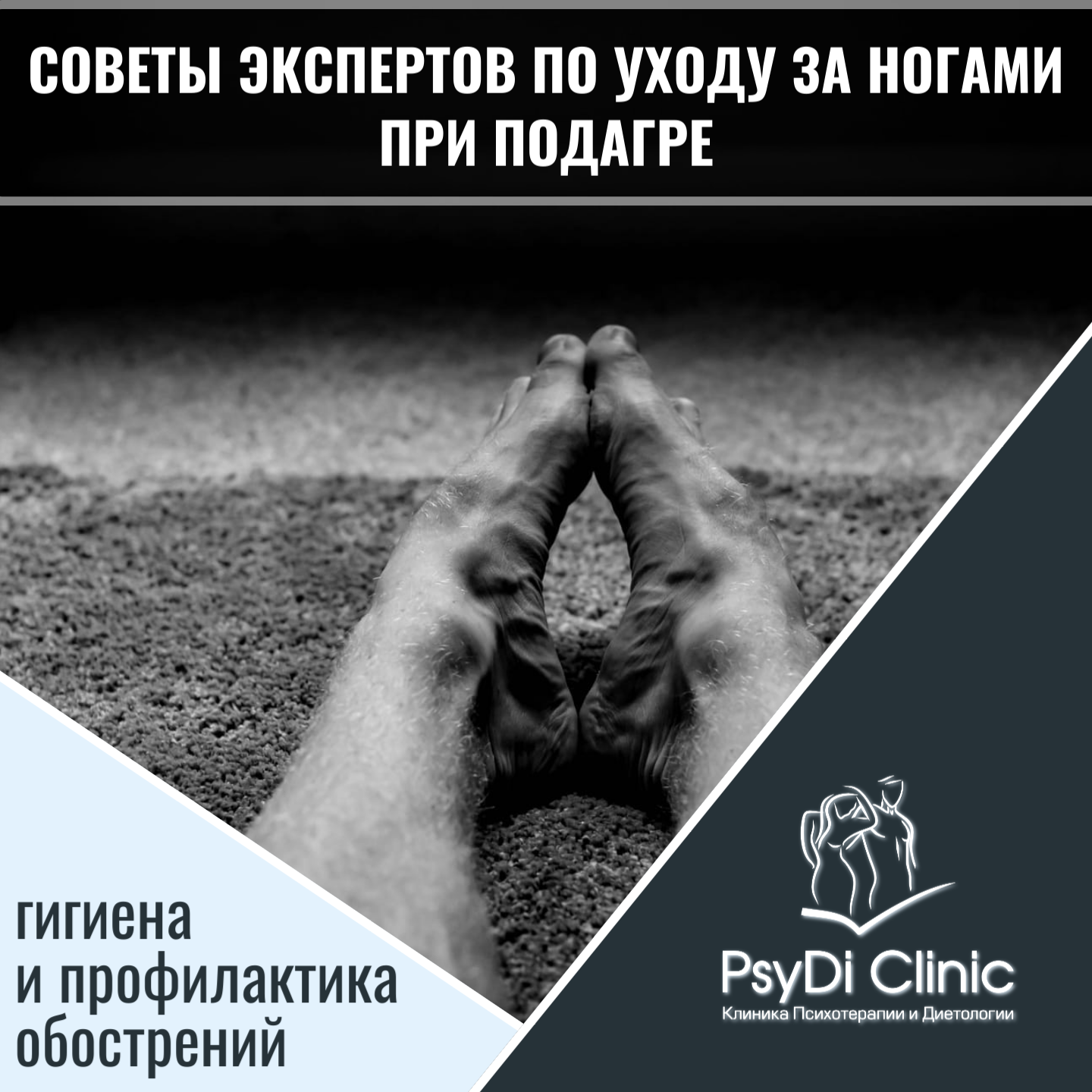 Советы экспертов по уходу за ногами при подагре: гигиена и профилактика обострений