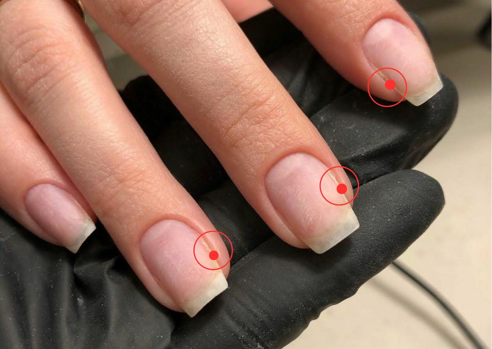 Эффект ракушки: как восстановить «волнистые» ногти в домашних условиях