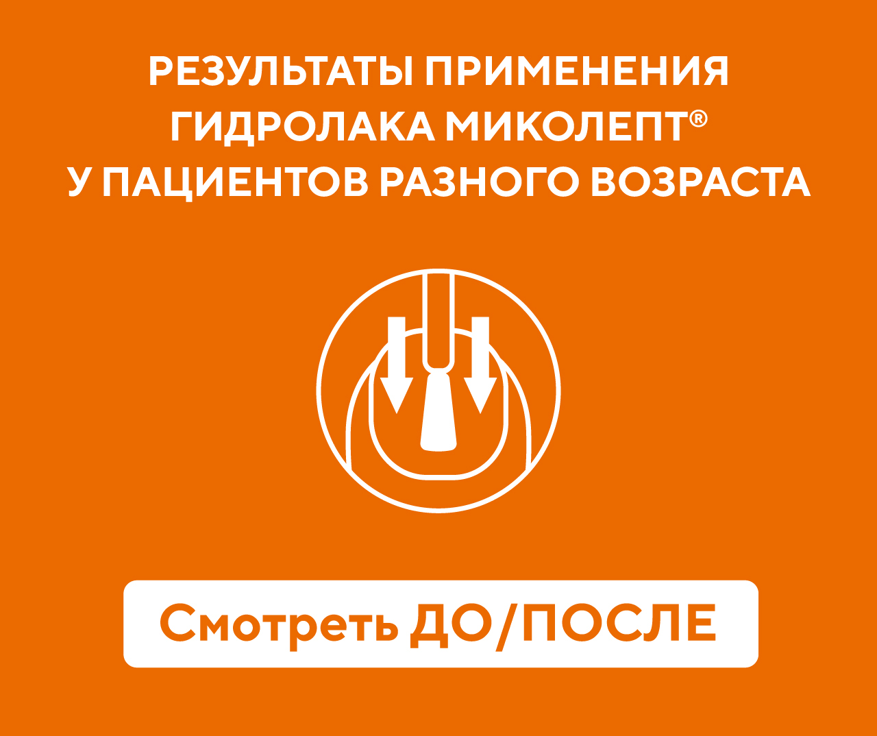 Миколепт® лак. Официальный сайт продукции