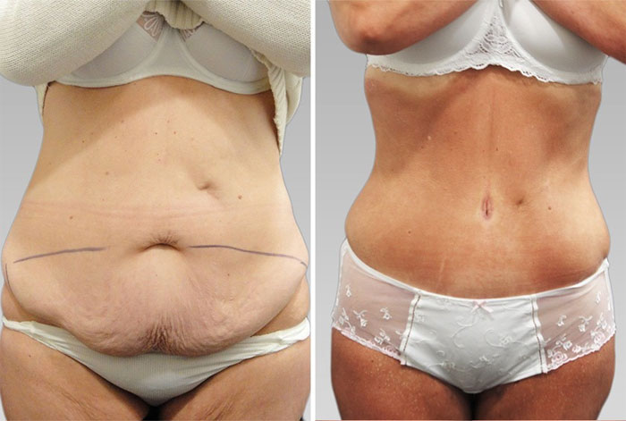 Пластическая хирургия