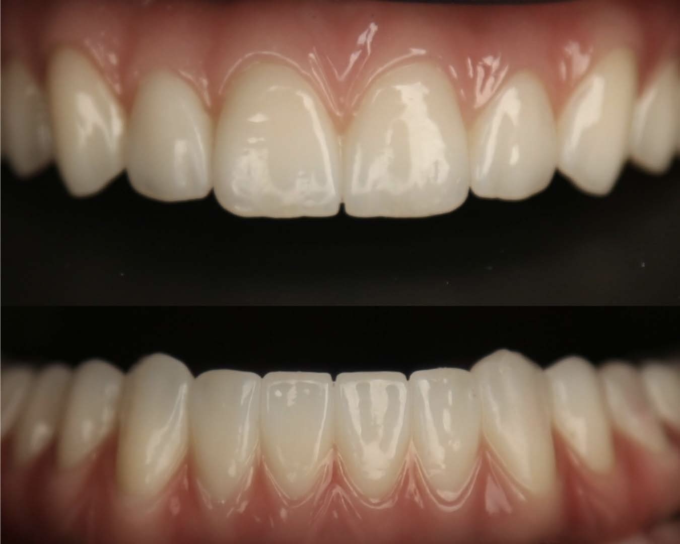 Восстановление всех зубов и полной функциональности , Стоматология Доктора Тарасовой