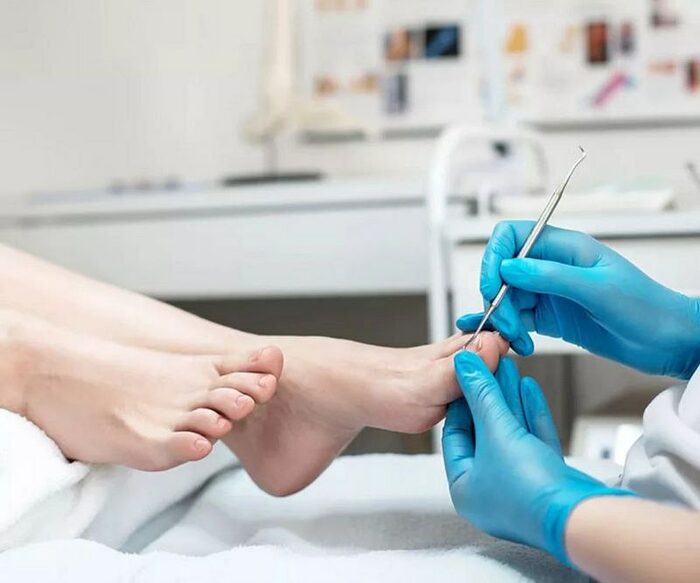 PODOSTART Педикюр. Сложные стопы и ногти