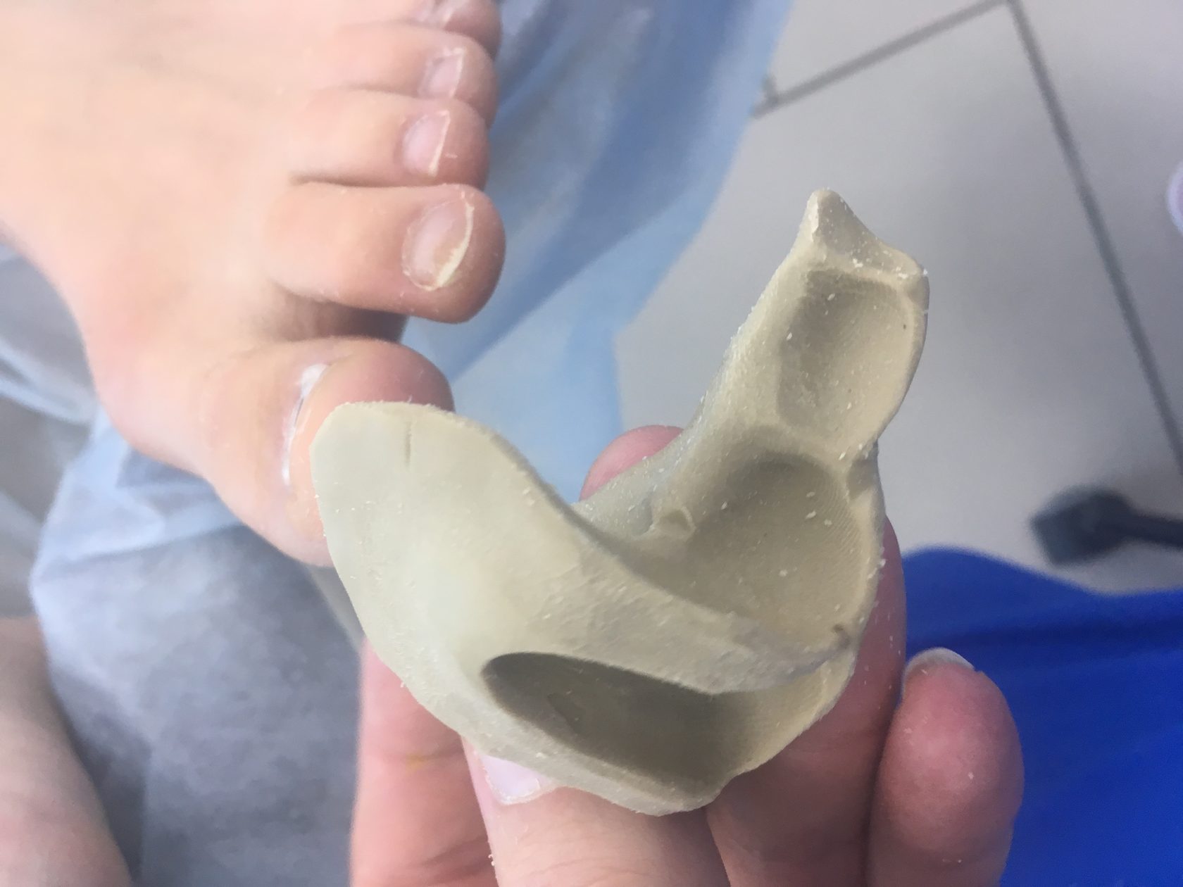 Изготовление индивидуальных ортозов для ног