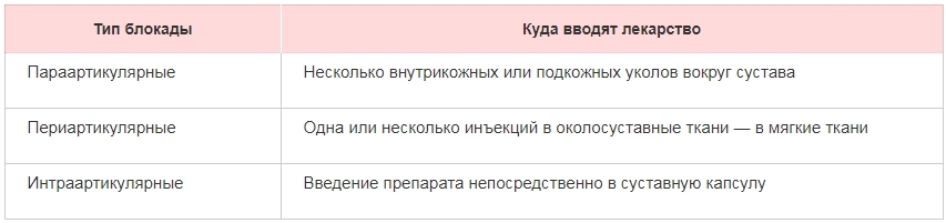 Лекарство Блокада Для Суставов Дипроспан