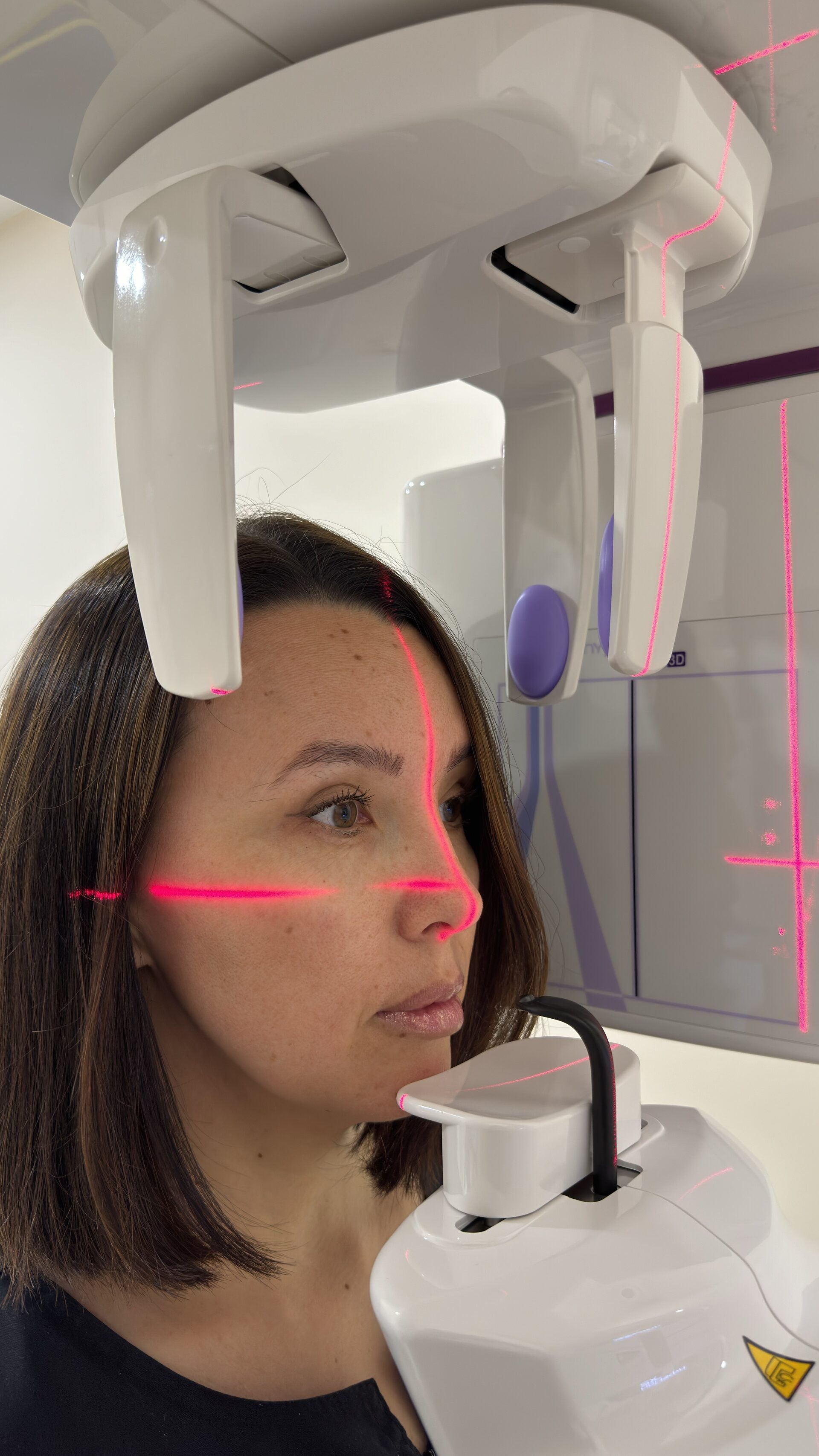 3д томография зубов в чебоксарах. 3Д КТ зубов в Чебоксарах