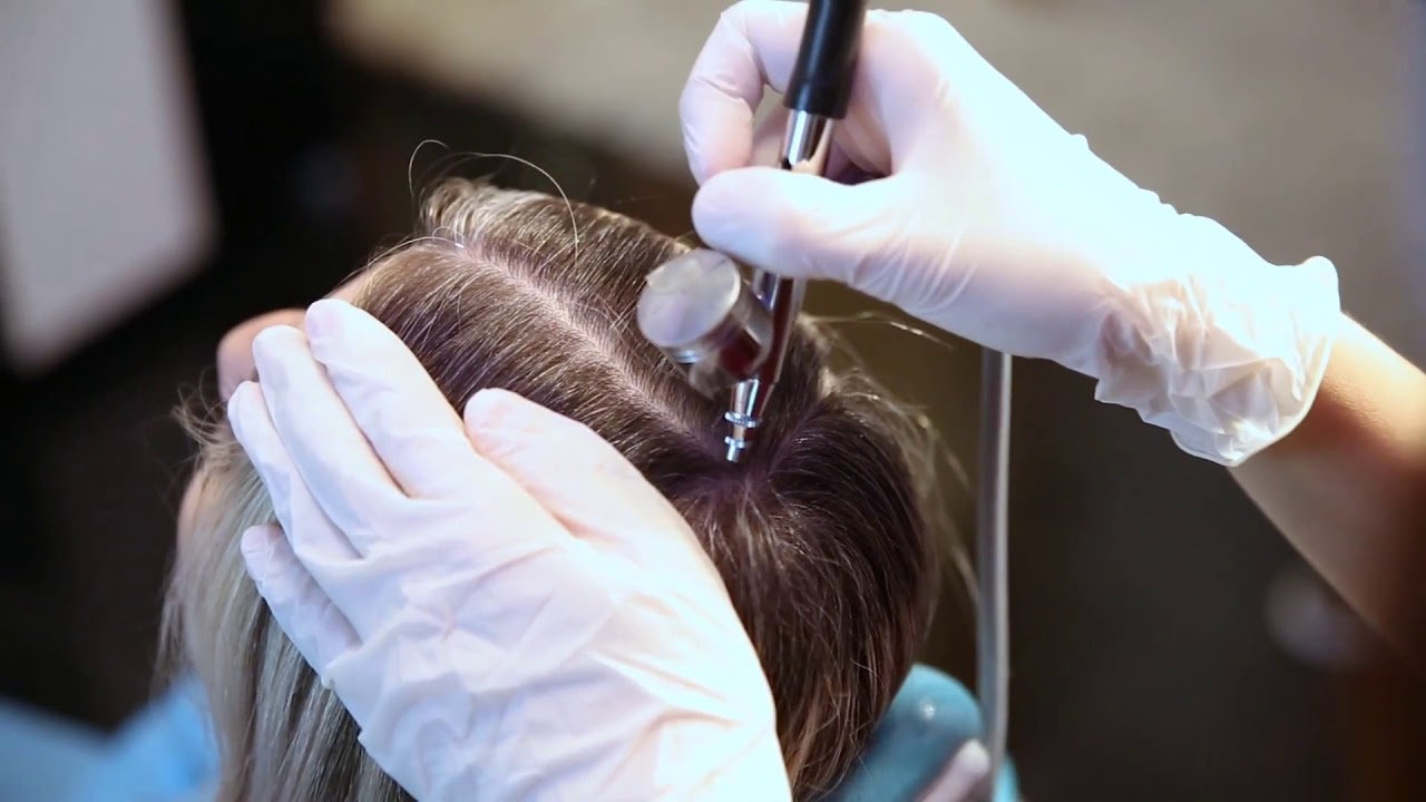 Можно ли во время мезотерапии волос красить волосы