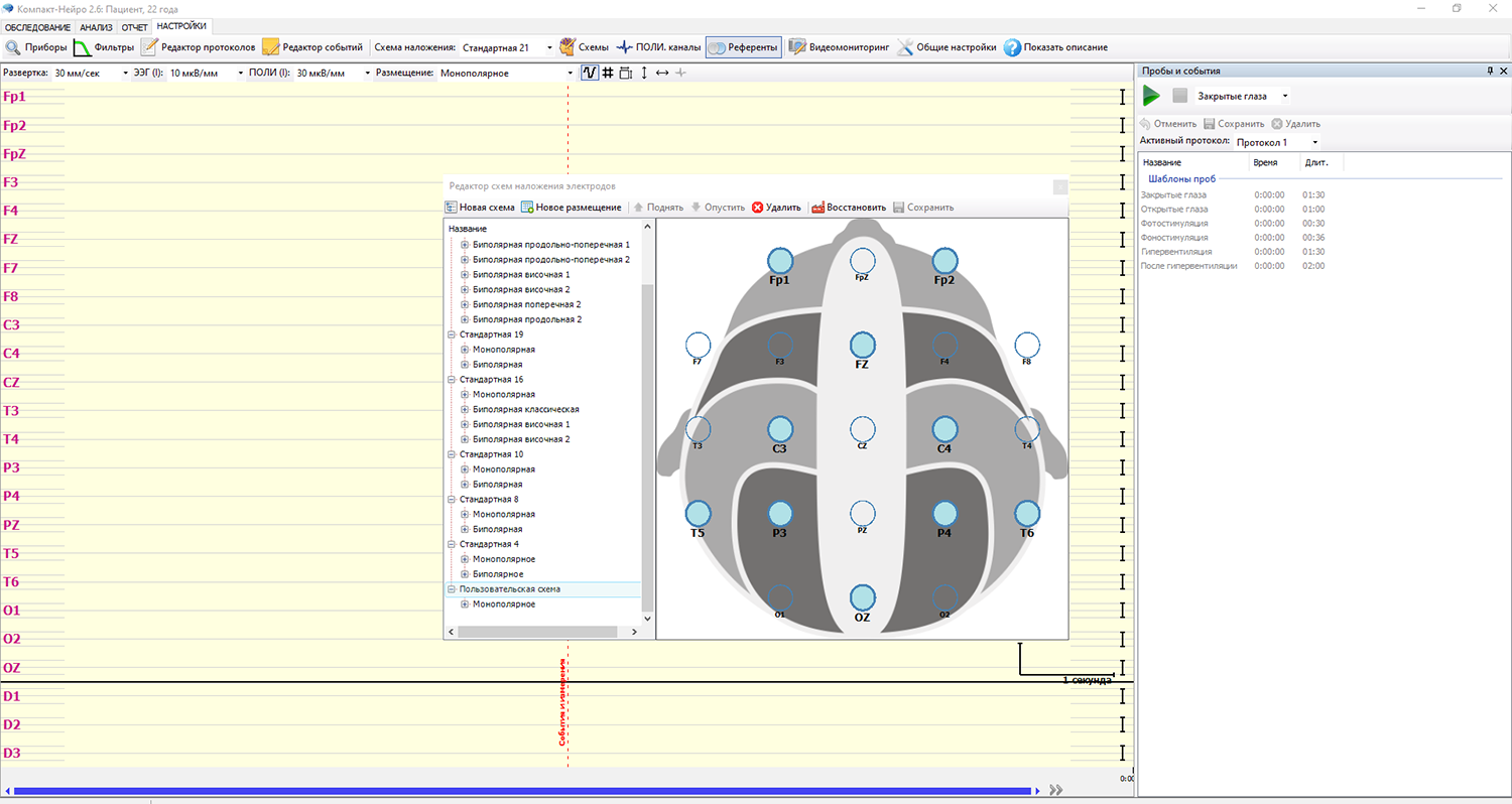Как включить поиск нейро. Компакт-Нейро 16-канальный. ЭЭГ компакт Нейро. Схема наложения электродов при ЭЭГ. ЭЭГ схема крепления электродов.