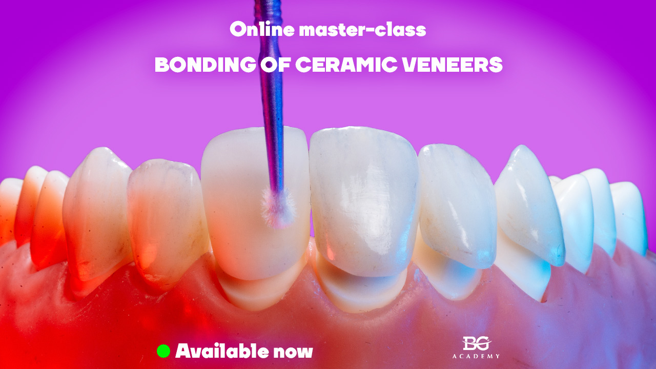 Bonding of ceramic veneers. Stepbystep protocols.