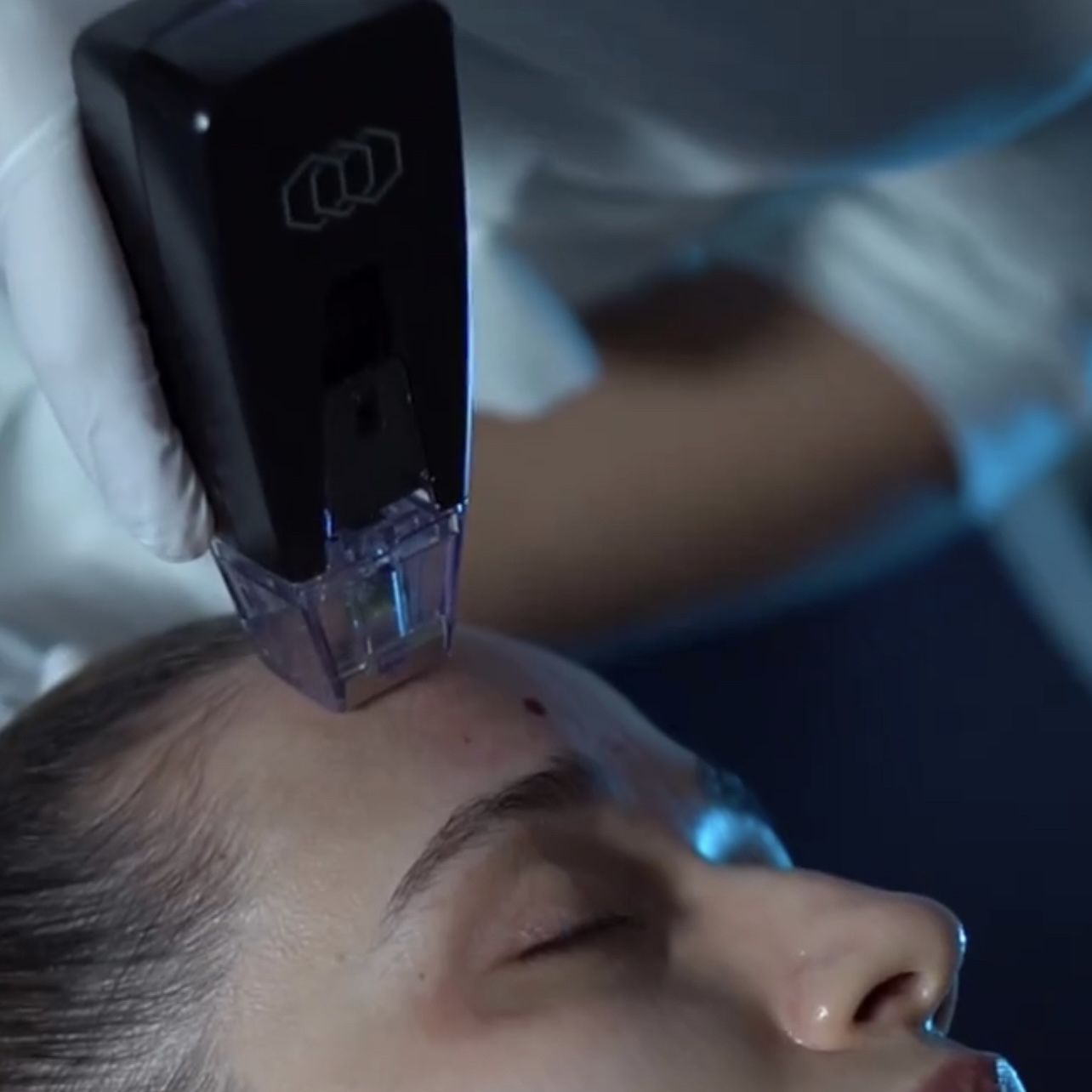 Morpheus 8 - игольчатый RF-лифтинг в Москве