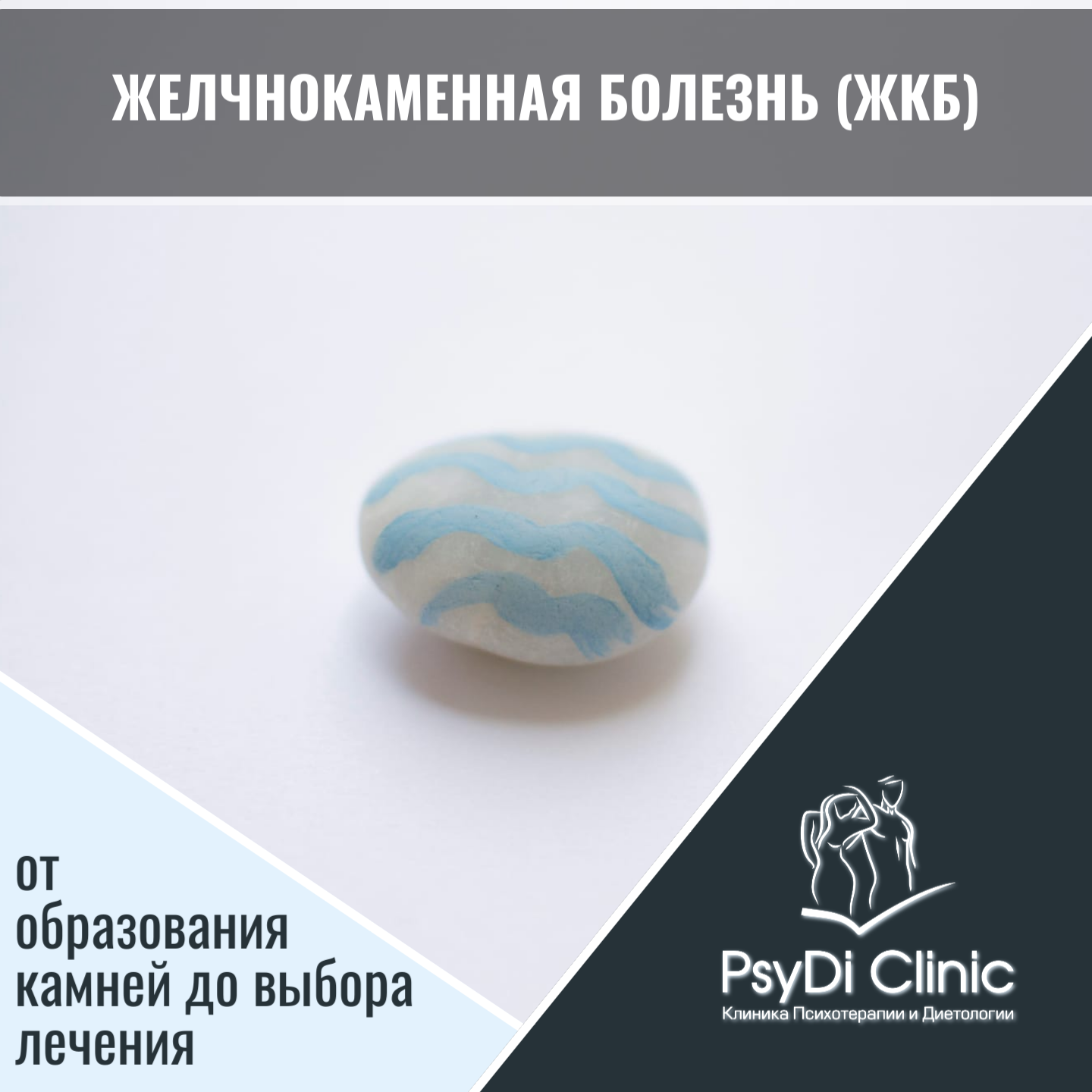 Желчнокаменная болезнь (ЖКБ): от образования камней до выбора лечения ��
