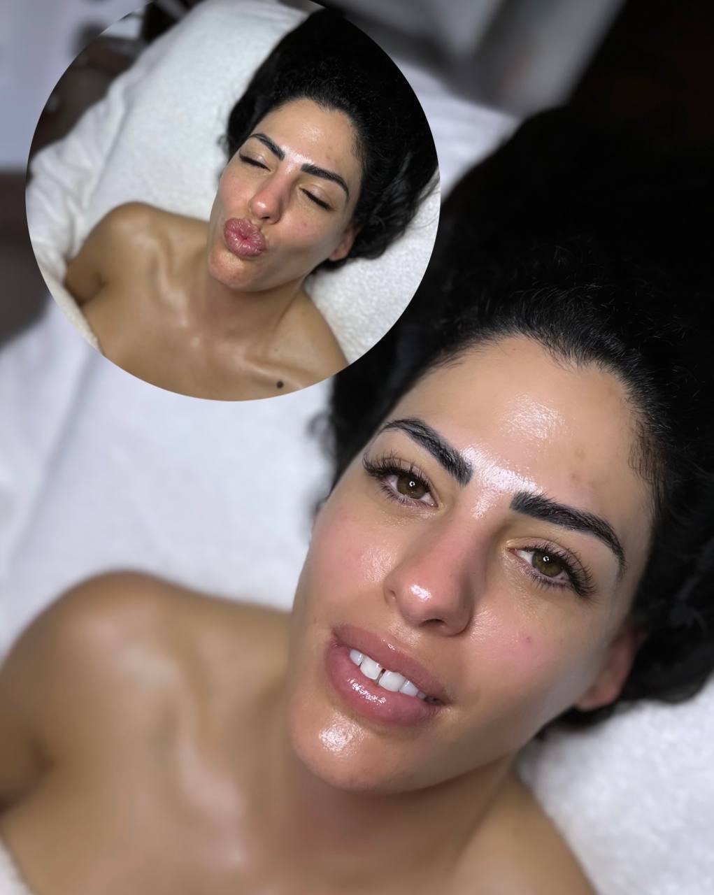 Before and after Red Carpet Facial — skin visibly more radiant and hydrated after one treatment, Beauty Studio by Hanna, Mount Pleasant SC
