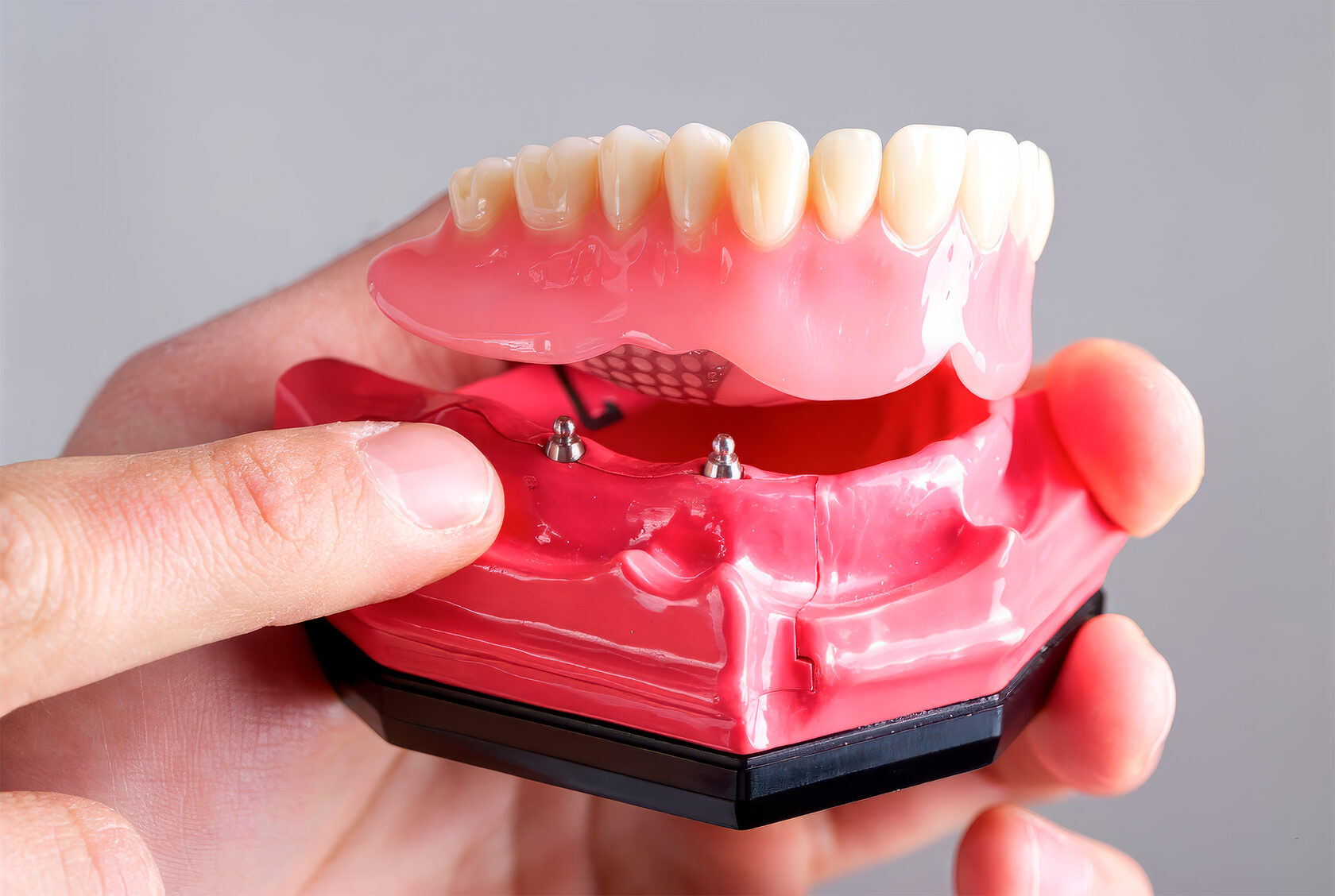 Установить зубные протезы