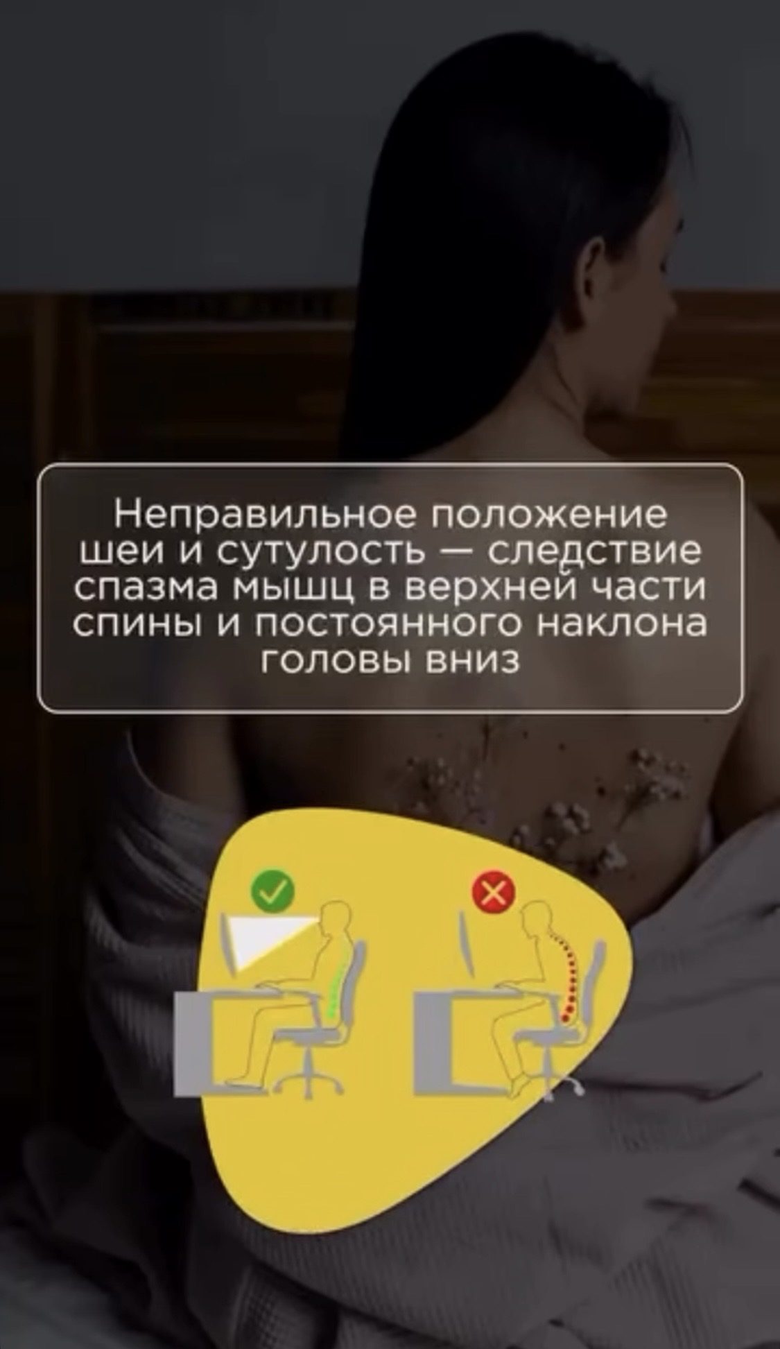 Неправильное положение шеи и сутулость — следствие спазма мышц в верхней части спины и постоянного наклона головы вниз.