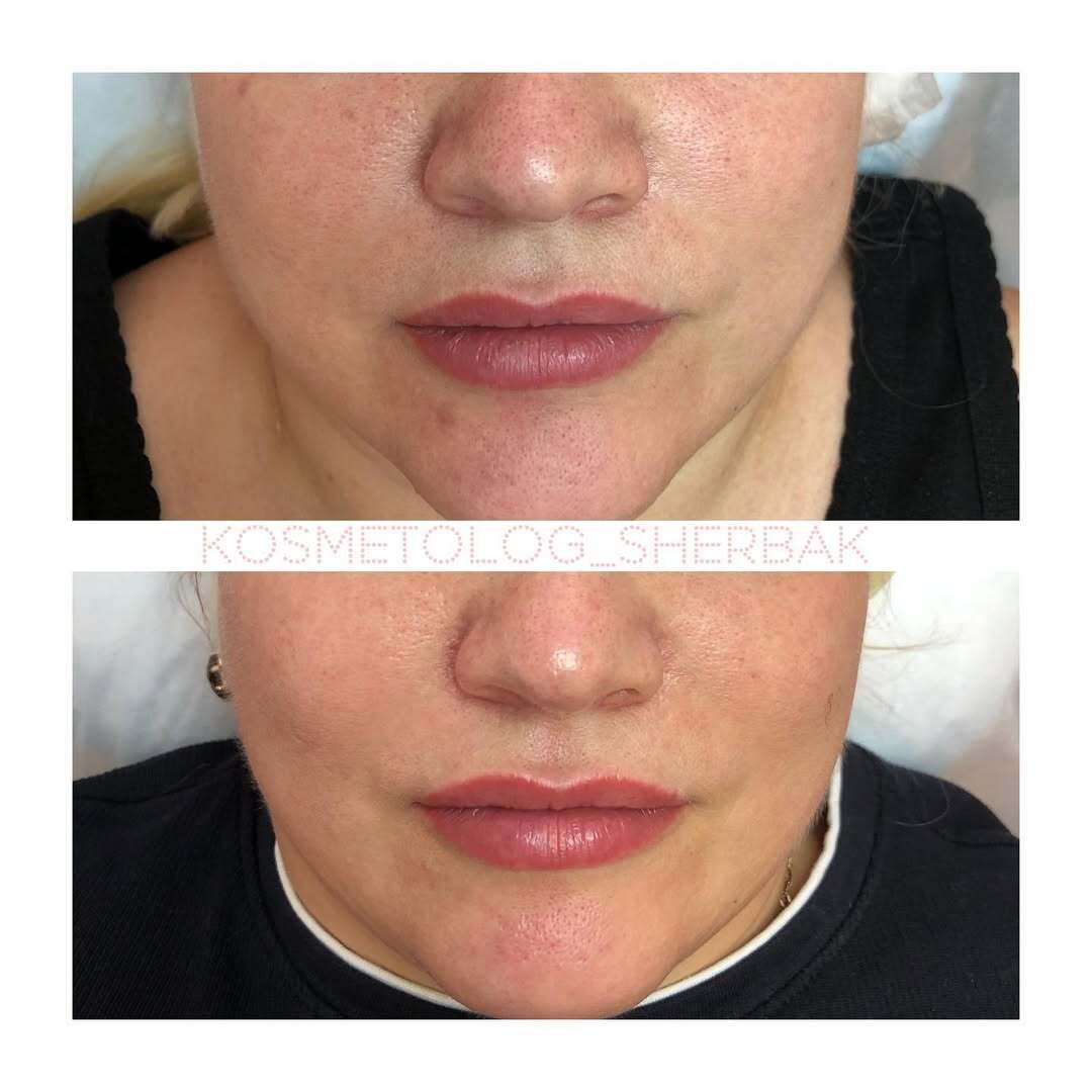 Индивидуальный подбор домашнего ухода в клинике PradusCOSMO, Санкт-Петербург. Косметологический анализ кожи и рекомендация профессиональной косметики