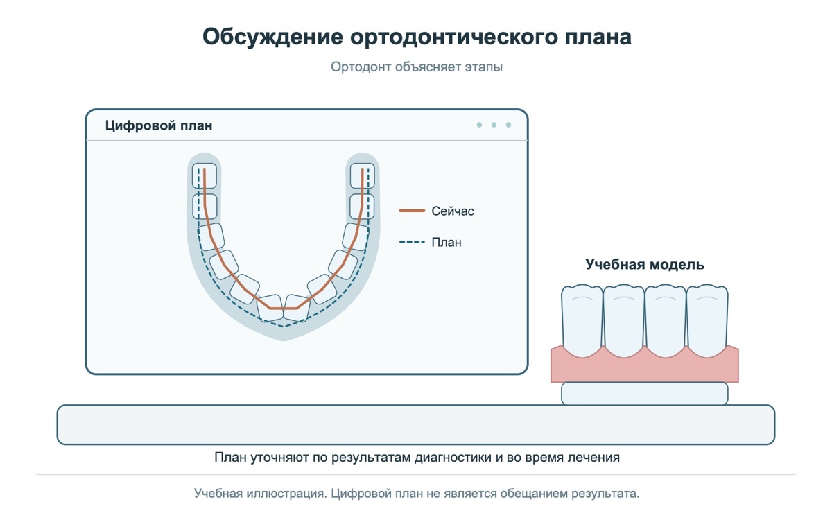Цифровой план ортодонтического лечения