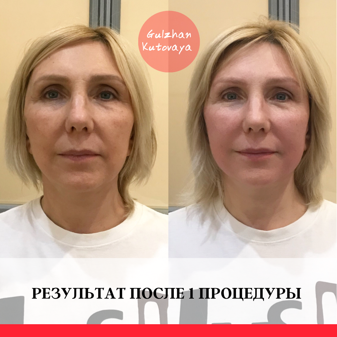 Коруги Москва