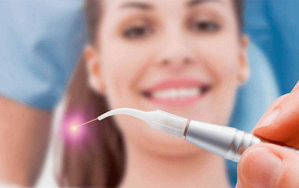 Лазерное десен. Стоматологический лазер. Лазерная терапия в стоматологии. Лазерный скальпель в стоматологии.