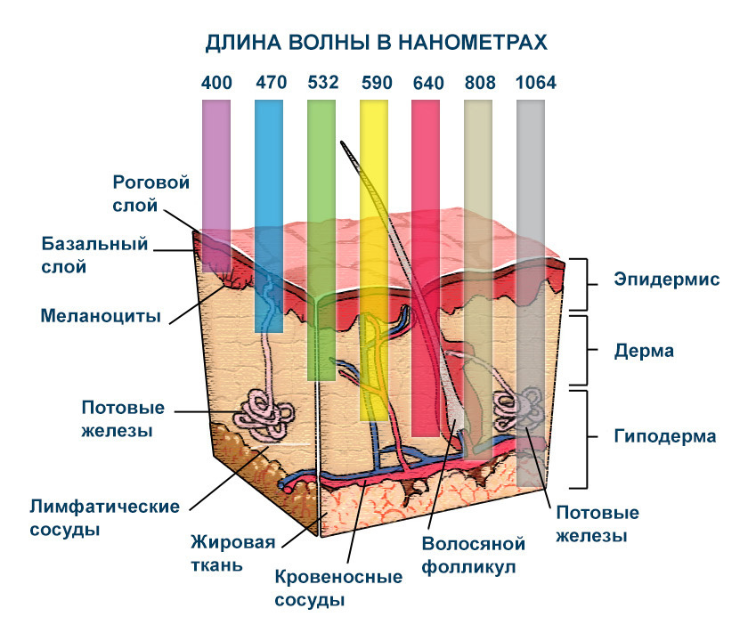 Селективный фототермолиз ND YAG Q-switch