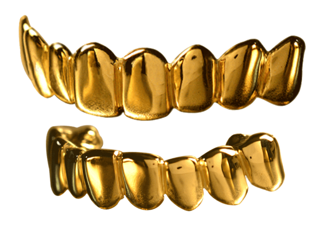 Главные отличия между стоматологическим и ювелирным золотом