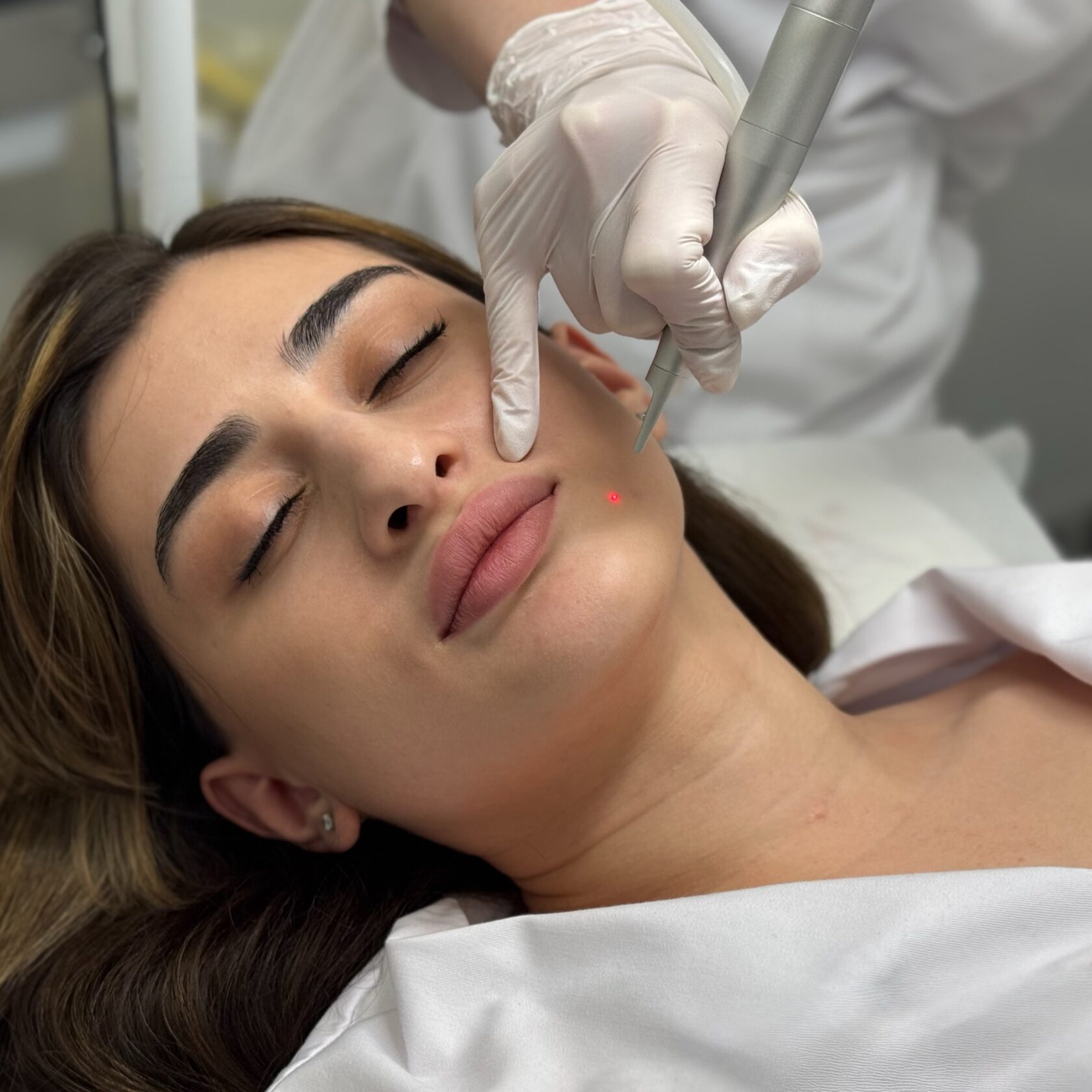 Лазерная косметология аппарат