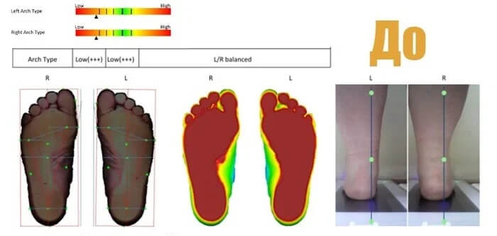 Консультация по 3D стелькам