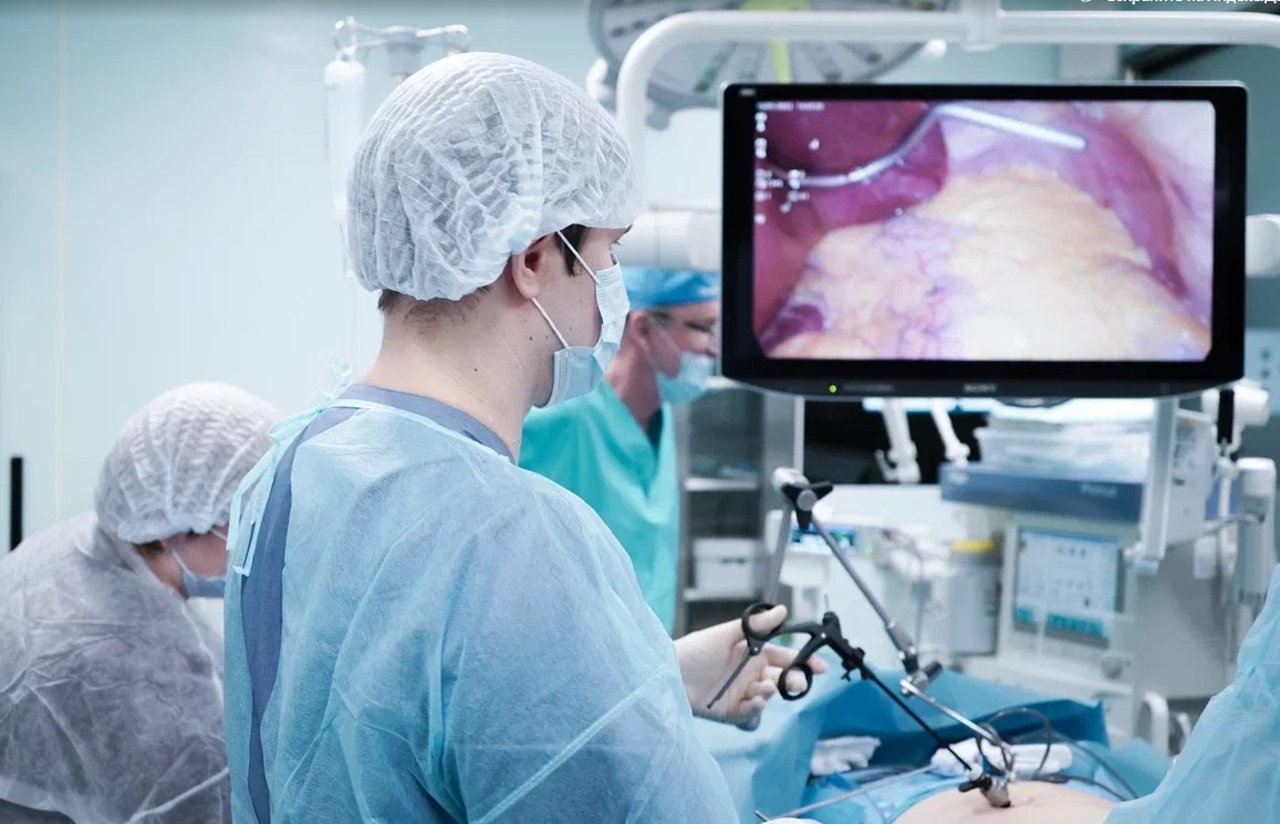 Виды бариатрических операций