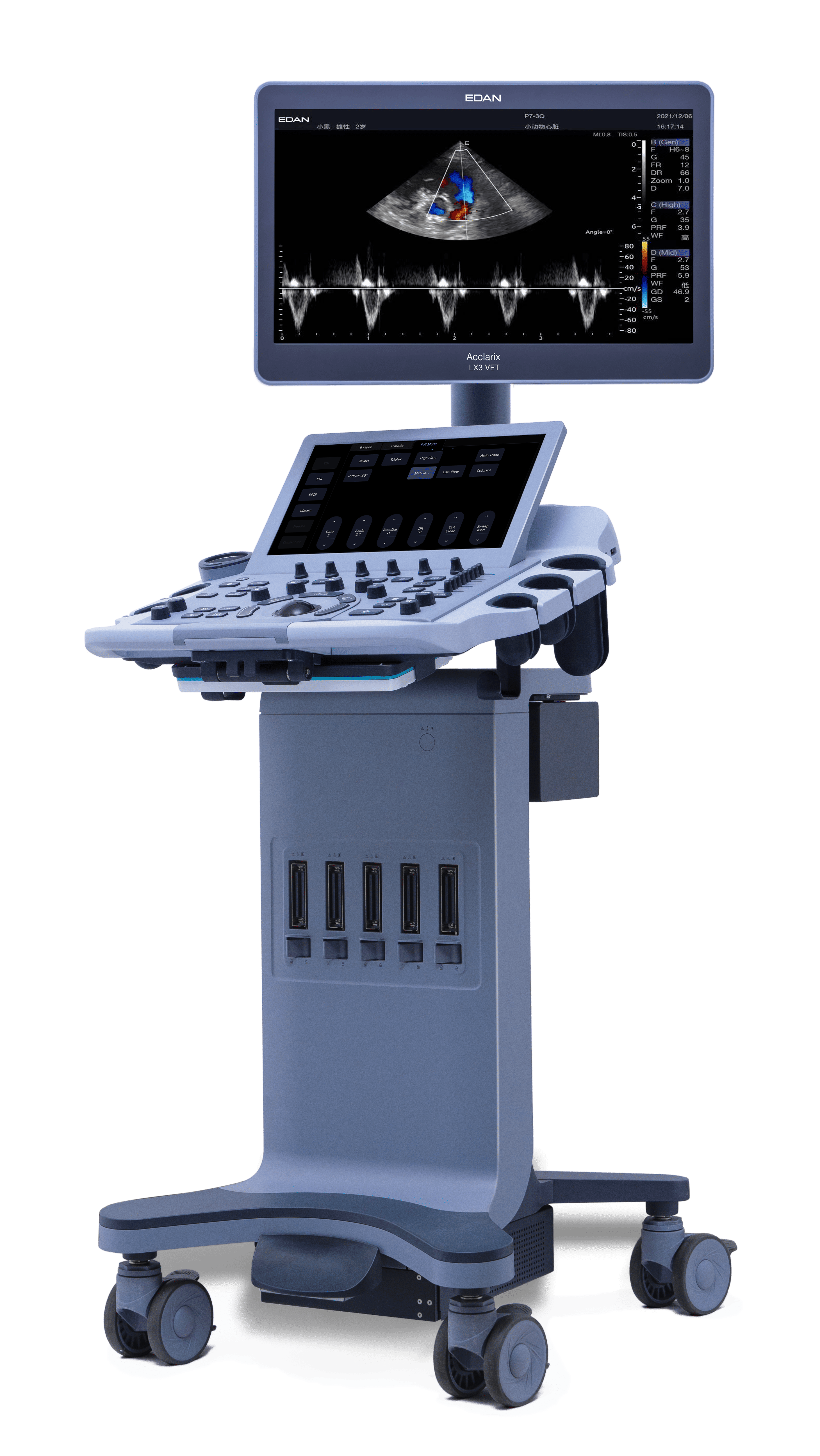 Acclarix LX3