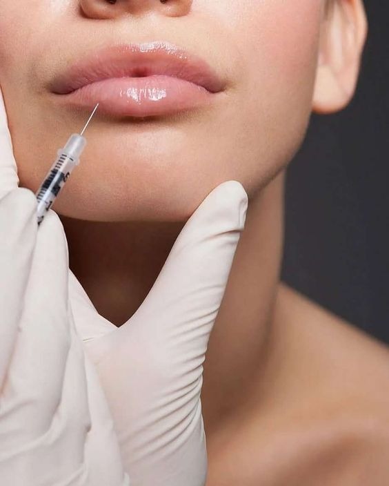Контурная пластика. Губы натуральный объем. Красивое увеличение губ skin expert. Фракционная мезотерапия губ. Красивое увеличение губ skin expert.