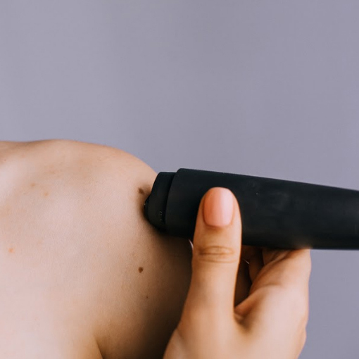 Does laser hair removal cause cancer?