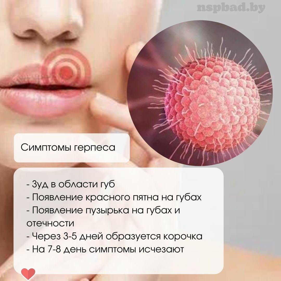 Чем мазать заживший герпес. Офтальмический герпес. Герп. Мазь от герпеса в интимной зоне название. Этапы заживления герпеса на губах.