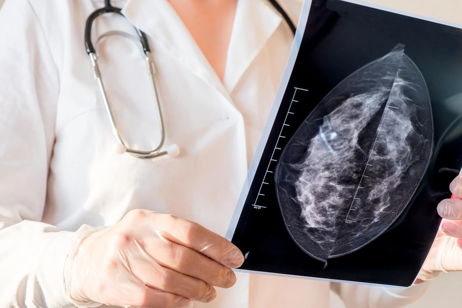 как делают маммографию груди у женщин фото 107