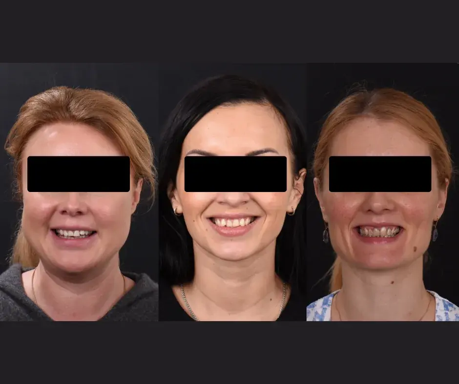 Фотопротокол лица пациента для планирования тотала