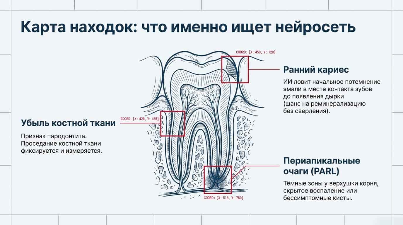 Что именно находит нейросеть на снимке зуба