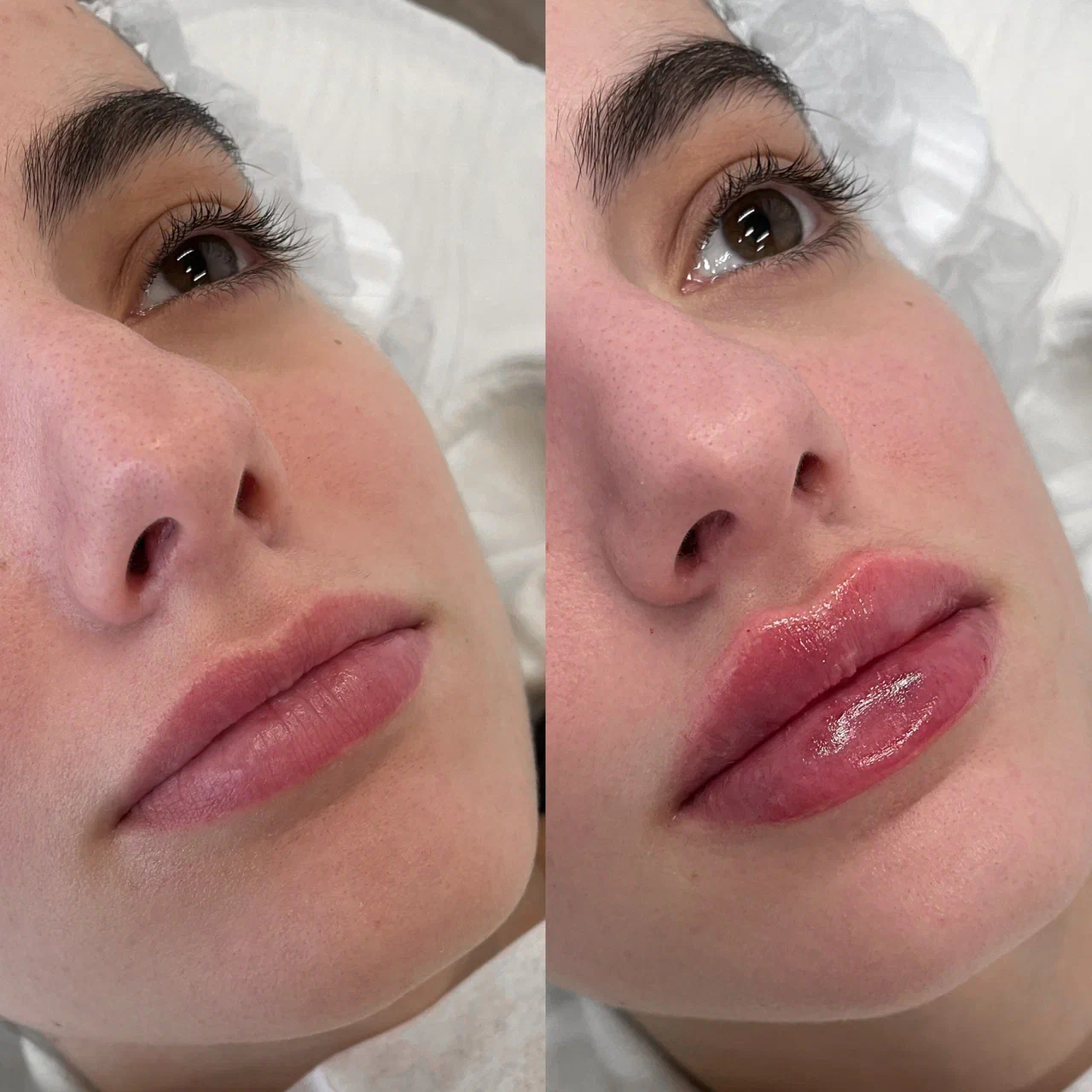 Материал из портфолио Inlove Beauty