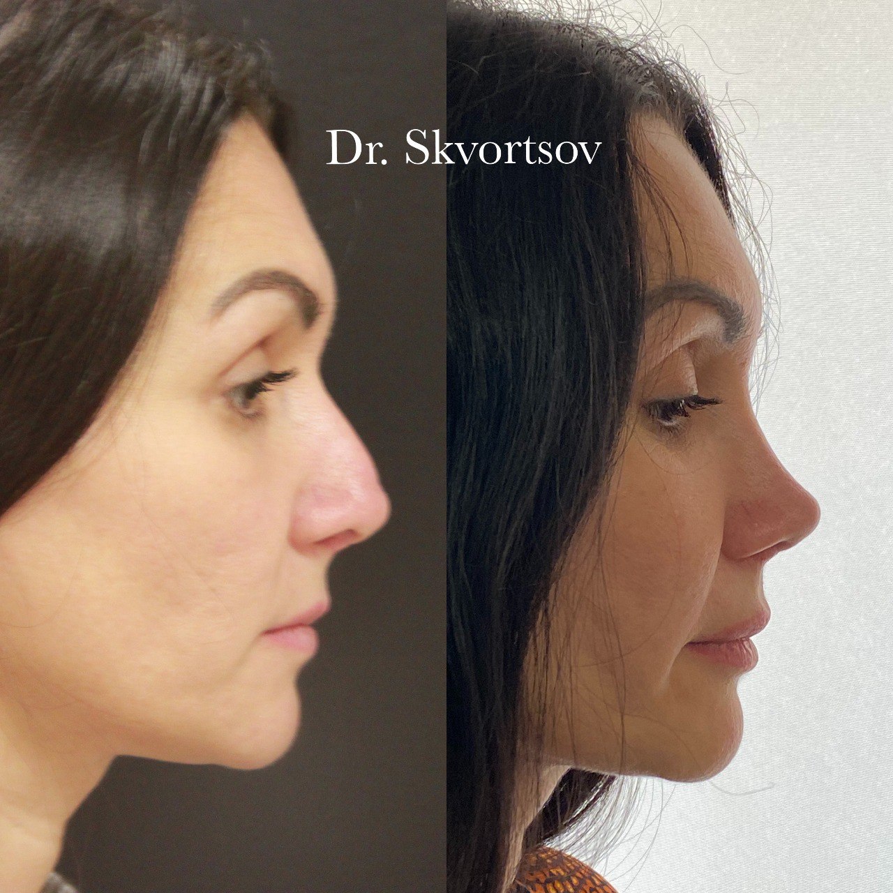 Хирург ринопластика москва