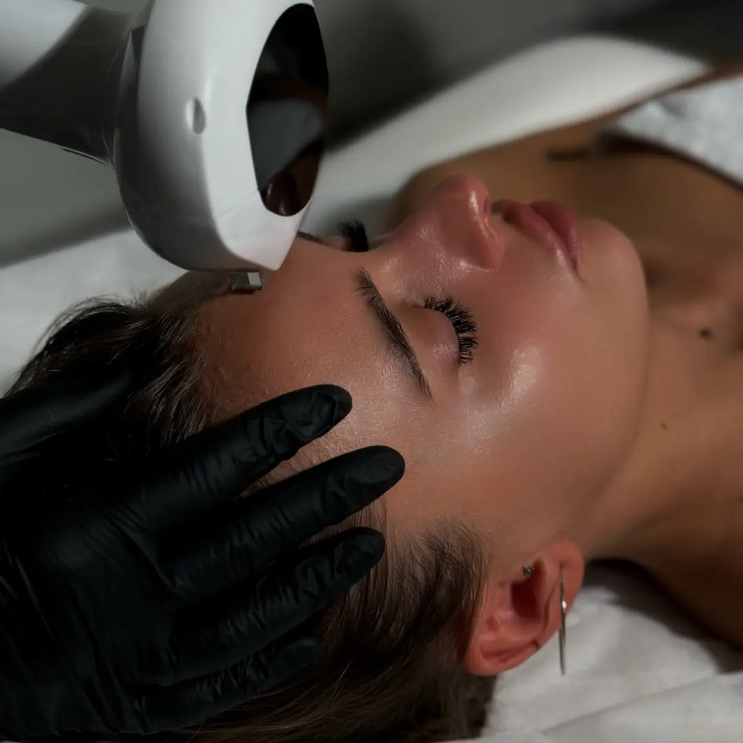 Процедура фотоомоложения лица в клинике косметологии Uniqderm