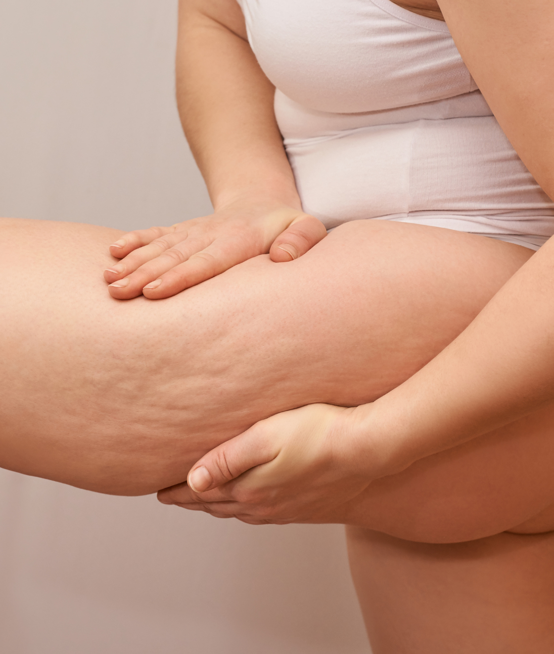 Allenamenti Efficaci Contro la Cellulite