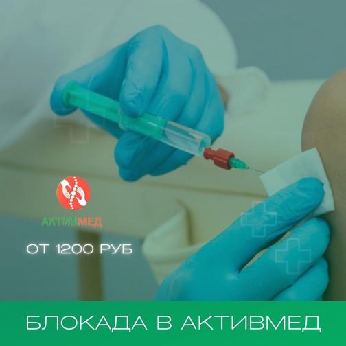 Медикаментозная блокада