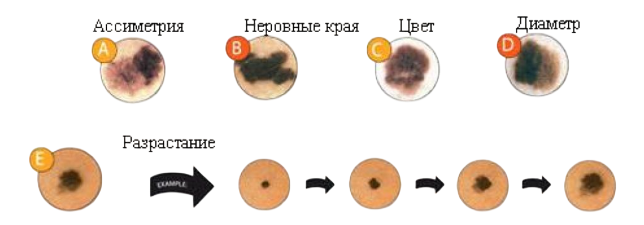 Правило ABCDE