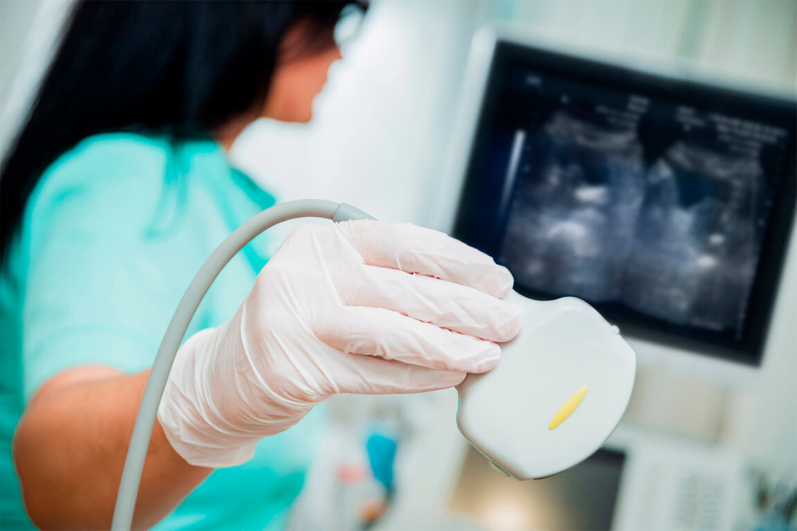 УЗИ контроль овуляции/Фолликулометрия