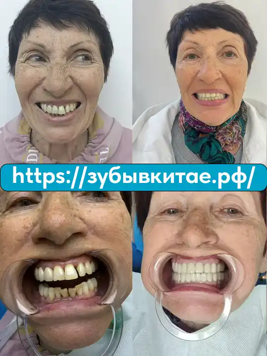 До и после — кейс 18